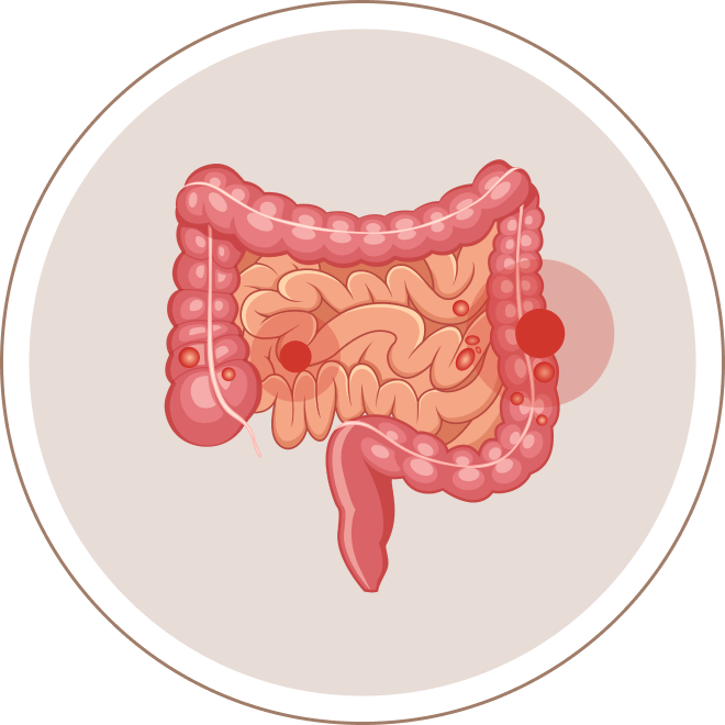 Nudge impact the gut